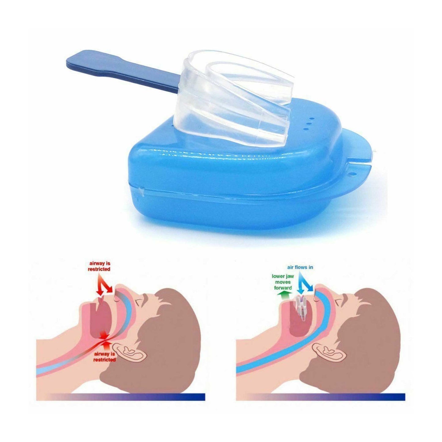 3x Mouthguard Mouthpiece + 3x Nose Clip Anti Snoring Aid Sleep Breathing Device-4