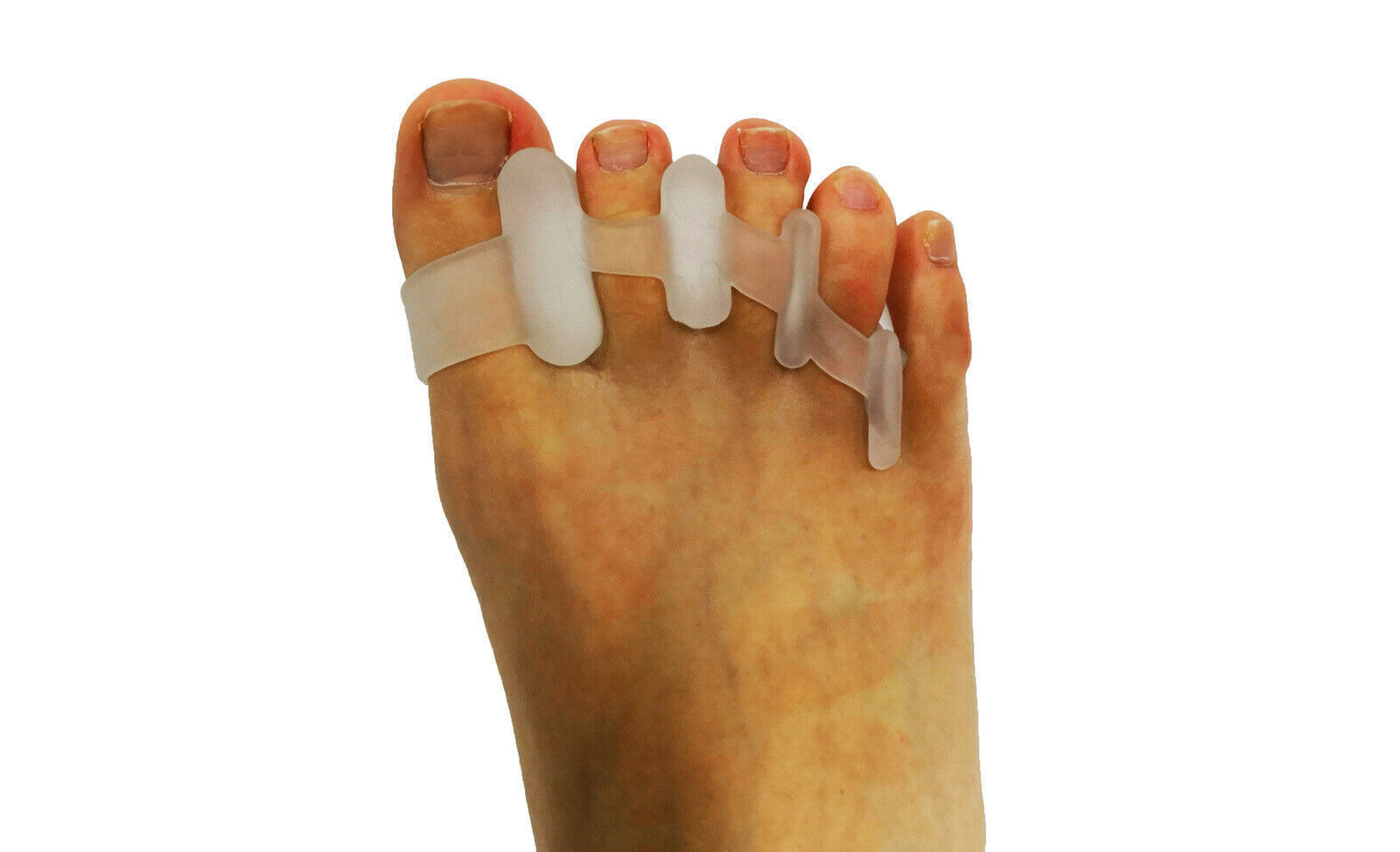 1 Pair Axign Medical Silicone Gel Functional Toe Separator Bunion Protector Pain-1