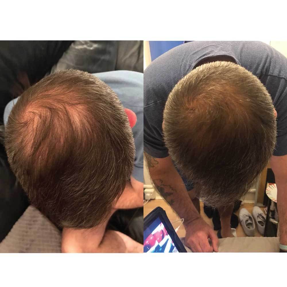 Watermans Condition Me Hair Growth Conditioner 250ml-4